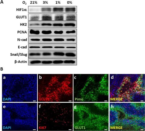 Expression Of Hypoxia Related Proteins In Hepg Cells A Hepg Cells