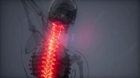 Backache In Backbone Science Anatomy Scan Of Human Spine Bones Glowing