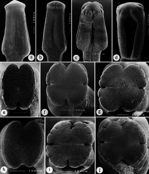 Scoleces Of Eubothrium Salvelini A E H And E Crassum Bd F G Download Scientific