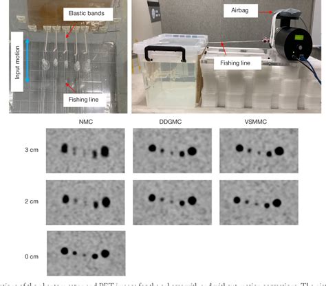 Figure 1 From Evaluation Of A Respiratory Motion Corrected Image