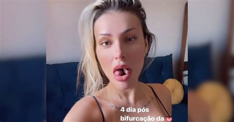 Após língua de cobra Andressa Urach faz novo procedimento