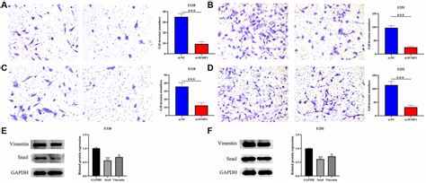 Sumf Overexpression Promotes Tumorous Cell Growth And Migration And Is