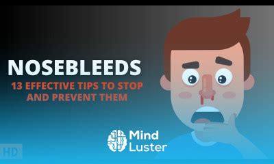 Learn Nosebleed What You Need To Know Mind Luster