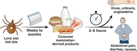 Understanding Mammalian Meat Allergy: A Tick's Impact on Anaphylaxis