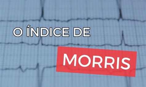 Índice de Morris Como Identificar a SAE no ECG Aprenda ECG