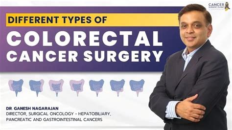 Colorectal Cancer Surgery: Types & Techniques - Dr. Ganesh Nagrajan ...