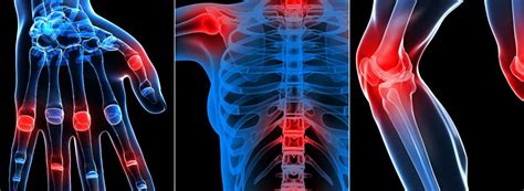 Clínica de reumatologia conheça a Clínica Croce Clinica Croce