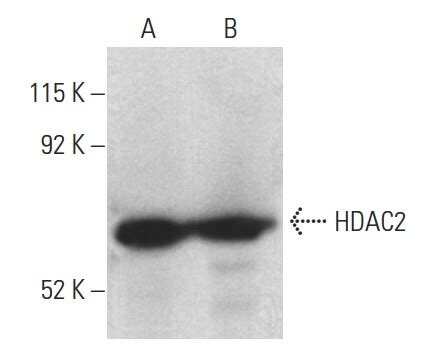 Anti Histone Deacetylase 2 HDAC2 Antibody 3F3 SCBT Santa Cruz