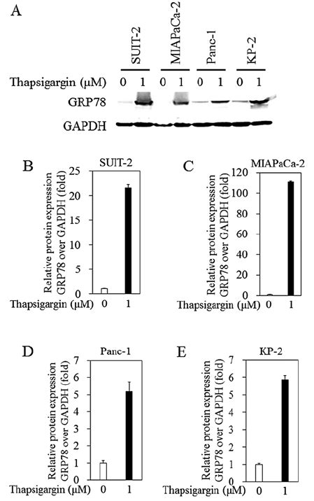 Effects Of Thapsigargin On Glucose Regulated Protein Grp Bip