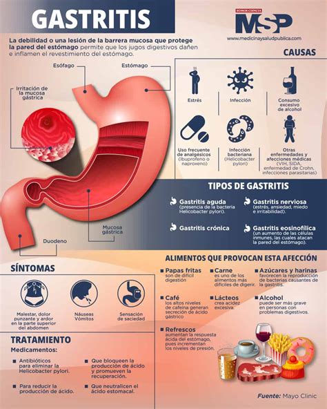 Gastritis Infografía