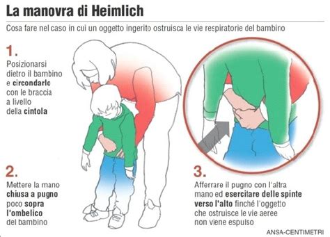 Manovre Di Disostruzione Pediatrica Spiegate Passo Passo