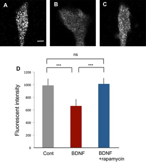 Quantitative Analysis Of EEF2 Phosphorylation Typical Confocal Laser