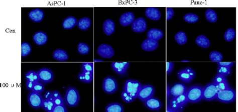 Silibinin Induced Cell Apoptosis In Aspc 1 Panc 1 And Bxpc 3 Cells