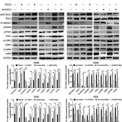 IR induced EMT progression by activating Rac1 signaling pathway in lung ... 