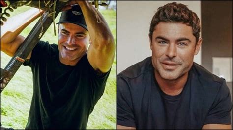 Zac Efron: Face Injury? Teeth Removal? Or Plastic Surgery?