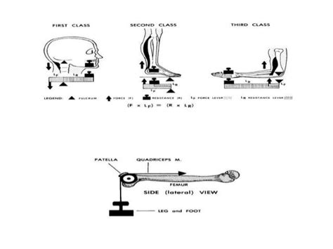 Fixed pulley