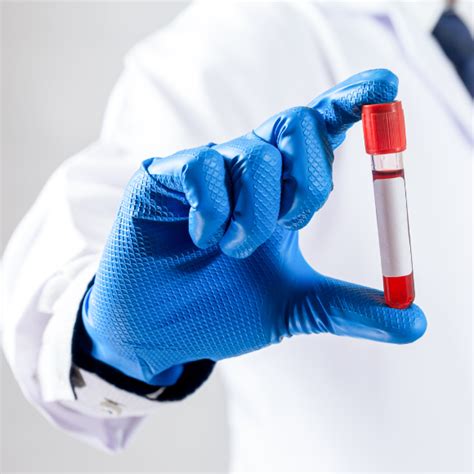 Simoa® for Early Detection of Blood-Based Biomarkers Associated with ...