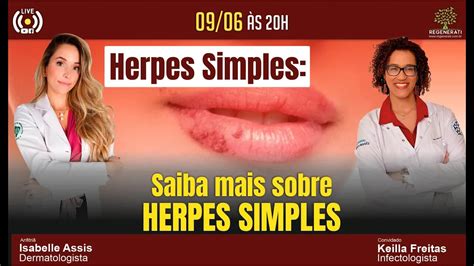 Herpes Simples Tudo Que Voc Precisa Saber