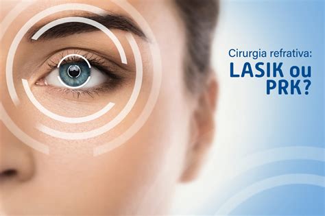 Cirurgia Refrativa Lasik Ou Prk Qual O Melhor M Todo Guia Sa De