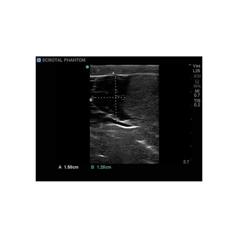 Scrotal Ultrasound Training Model Elevate Healthcare