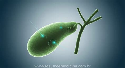 Como É A Cirurgia De Vesícula - Colecistectomia: Guia Completo da Cirurgia de Remoção da Vesícula ...