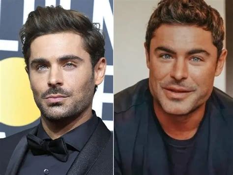 What Happened To Zac Efron He Breaks Silence