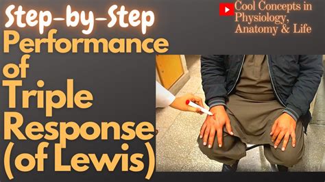 Master How To Perform Triple Response Of Lewis 1st Prof Mbbs Physiology Practical Youtube