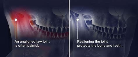 Can Wisdom Teeth Cause Tmj Boston Dentist Congress Dental Group