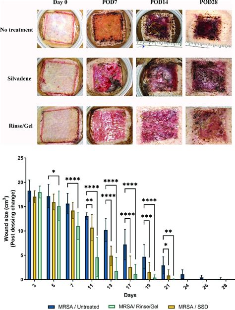 A Representative Images Of Mrsa Infected Ptbw S Treated With Ssd And