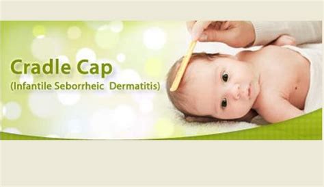 Olive Oil For Cradle Cap Treatment How To Use Is Olive Oil Good For