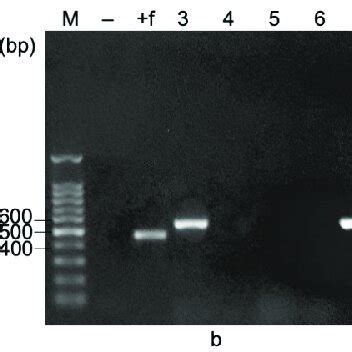 F And Pet B Flicgfp After Digesting With A Bamhi And Xhoi B