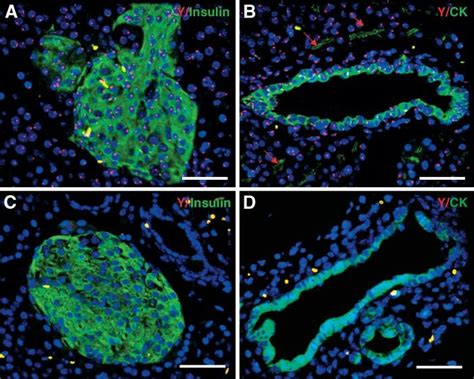 Efficient Detection Of Y Chromosome In Murine Pancreas Dual Staining