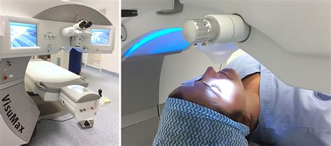 Chirurgie Yeux Laser Smile Clinique Ophtalmologique Paris