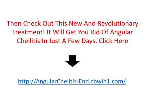 PPT - Cut In Corner Of Mouth, Angular Chelitis, Angular Cheilitis