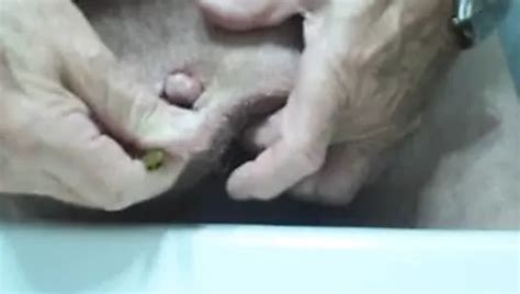 Penectomy Free Solo Man Porn Video B1 XHamster
