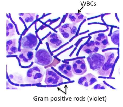 Listeria Gram Stain Morphology Microbiology Case Study An Month