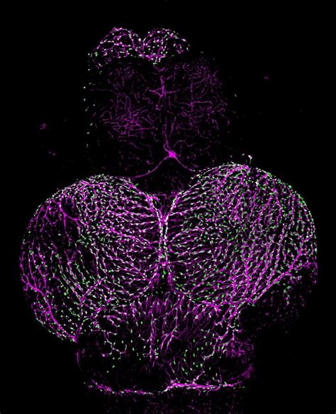 Nih Researchers Trace Origin Of Blood Brain Barrier Sentry Cells