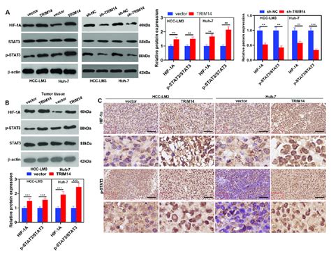 Trim14 Overexpression Activated Stat3hif 1α Expression In Hcc Tissues