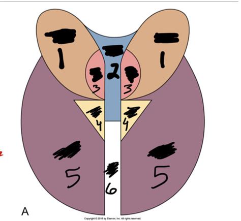 Sectional Anatomy Section 2 Male Pelvis And Female Pelvis Flashcards