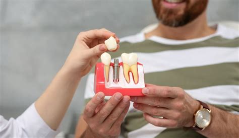 Implante dental vs prótesis removible ventajas y desventajas