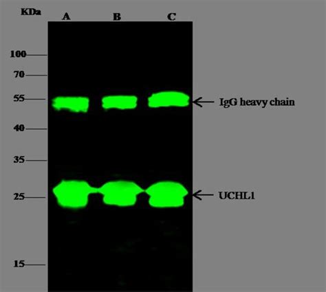 PGP9 5 Recombinant Rabbit Monoclonal Antibody 104 Invitrogen 100 μL