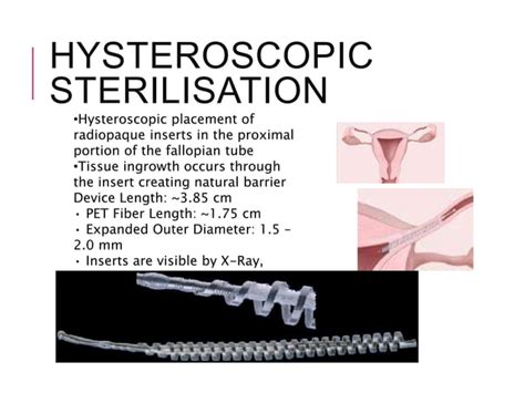 Operative Hysteroscopy Ppt