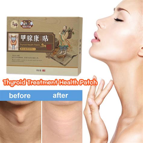 Pcs Box Hyperthyroidism Thyroid Treatment Health Patch Hyperthyroidism