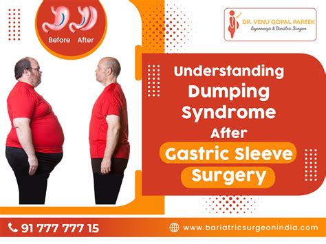 Understanding Dumping syndrome after Gastric Sleeve Surgery - Bariatric Surgeon India