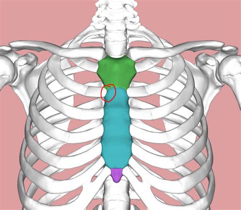 Hard lump on the right side of my sternum at manubriosternal joint ...