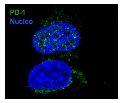 Tumore Scoperto Come Le Cellule Cancerogene Ingannano Il Tuo Sistema