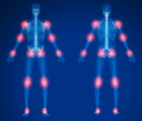 Body Pain – Fedorko Health