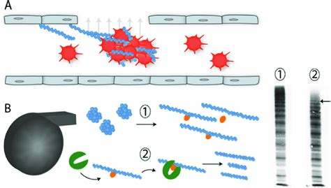 Proposed Mechanisms Of Acquired Von Willebrand Disease In Ventricular