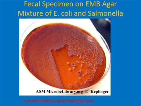 Day 2 Dr Felton Salmonella And Shigella Flashcards Quizlet