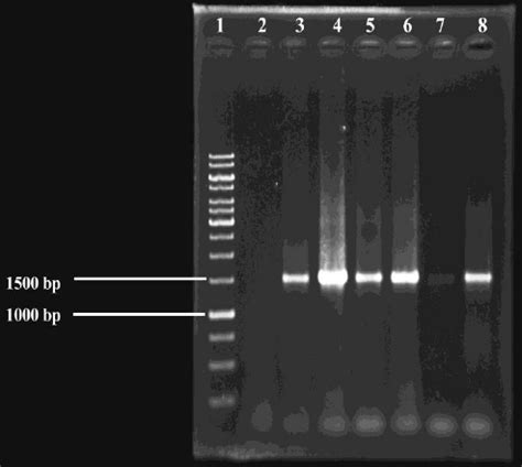 Agarose Gel Electrophoresis After 16S RDNA Amplification Lane 1